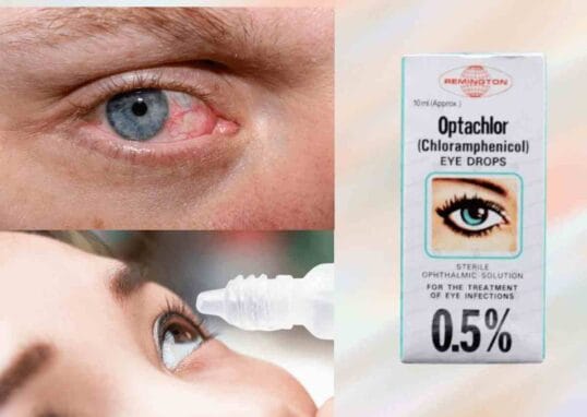 optachlor eye drops