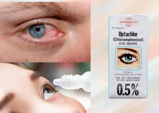 optachlor eye drops