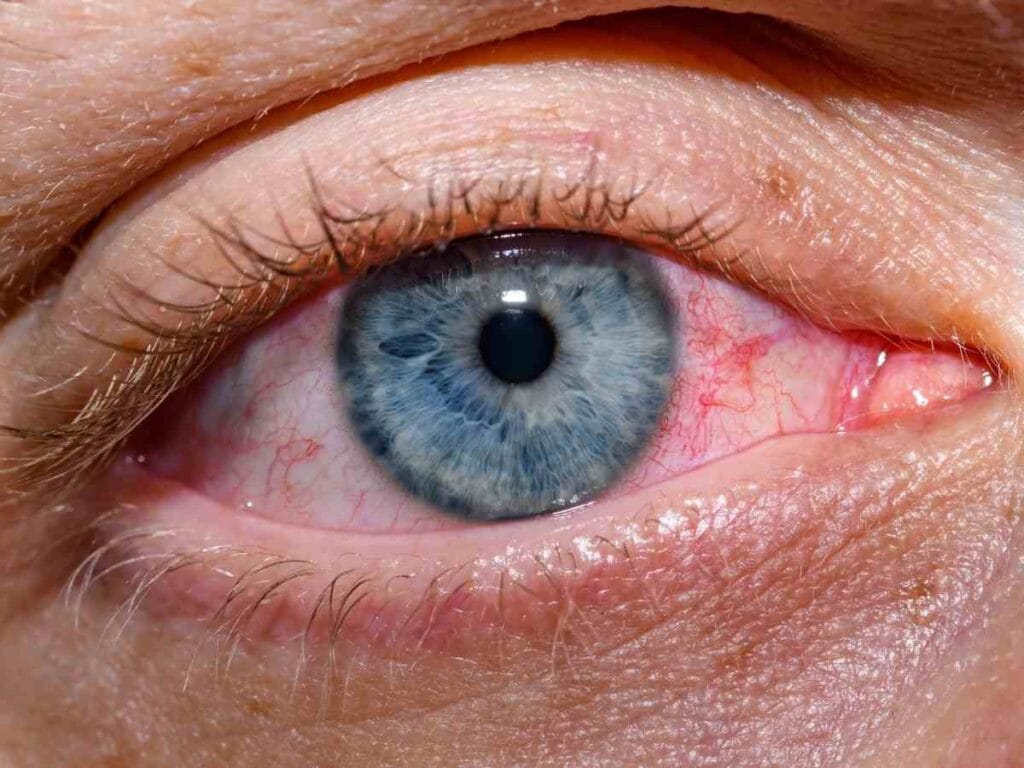 optachlor eye drops uses